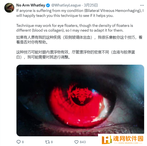 永不言弃！《英雄联盟》主播因意外几乎全盲：靠自创“真实技能”重回大师